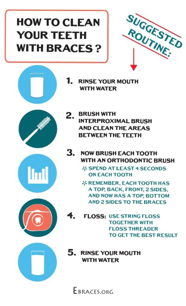 how-to-clean-your-teeth-with-braces-infographic