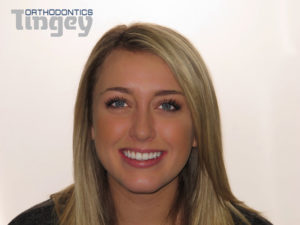 Meridian orthodontic patient after braces