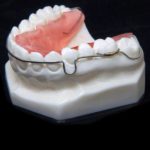 Retainer wire for dental braces