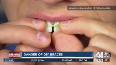 Boise orthodontist working on teeth